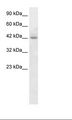 RGS20 / RGSZ1 Antibody - HepG2 Cell Lysate.  This image was taken for the unconjugated form of this product. Other forms have not been tested.