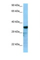 RGS4 Antibody - RGS4 antibody Western blot of HepG2 Cell lysate. Antibody concentration 1 ug/ml.  This image was taken for the unconjugated form of this product. Other forms have not been tested.