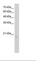 RGS8 Antibody - HepG2 Cell Lysate.  This image was taken for the unconjugated form of this product. Other forms have not been tested.