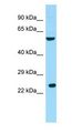 RGS9BP Antibody - RGS9BP antibody Western Blot of HeLa cell lysate.  This image was taken for the unconjugated form of this product. Other forms have not been tested.