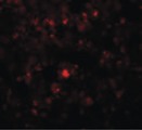 RHBDD2 Antibody - Immunofluorescence of RHBDD2 in Rat Lung cells with RHBDD2 antibody at 20 ug/ml.