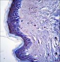 RHBDF2 Antibody - RHBDF2 Antibody immunohistochemistry of formalin-fixed and paraffin-embedded human skin tissue followed by peroxidase-conjugated secondary antibody and DAB staining.