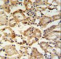 RHBG Antibody - RHBG Antibody IHC of formalin-fixed and paraffin-embedded mouse kidney tissue followed by peroxidase-conjugated secondary antibody and DAB staining.