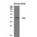 RHD Antibody - Western blot of CD240d antibody
