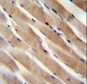 RHEB Antibody - RHEB Antibody immunohistochemistry of formalin-fixed and paraffin-embedded human skeletal muscle followed by peroxidase-conjugated secondary antibody and DAB staining.