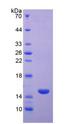 CD40L Protein - Recombinant Cluster Of Differentiation 40 Ligand By SDS-PAGE