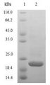 IL-10 Protein - (Tris-Glycine gel) Discontinuous SDS-PAGE (reduced) with 5% enrichment gel and 15% separation gel.