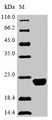 IL-10 Protein - (Tris-Glycine gel) Discontinuous SDS-PAGE (reduced) with 5% enrichment gel and 15% separation gel.