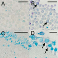 Rhinovirus Antibody - IHC staining for viral capsid protein with #18758: (A) Uninfected HeLa cells, (B) HRV16-infected HeLa cells, (C) Negative bronchial biopsy section, (D) Positive bronchial biopsy section.
