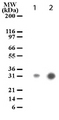 Rho Kinase / ROCK1 Antibody - Detection of cleaved ROCK-1 in apoptotic Jurkat cell lysates (10 µg/lane). Lane 1. Jurkat cells were treated with camptothecin. Lane 2. Jurkat cells were treated with anti-Fas antibody (10 ng/ml for 2 hrs). antibody was used at a concentration of 1 ug/ml.