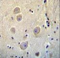 RHOB Antibody - ARHB Antibody immunohistochemistry of formalin-fixed and paraffin-embedded human brain tissue followed by peroxidase-conjugated secondary antibody and DAB staining.