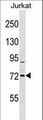 RHOBTB1 Antibody - RHOBTB1 Antibody western blot of Jurkat cell line lysates (35 ug/lane). The RHOBTB1 antibody detected the RHOBTB1 protein (arrow).