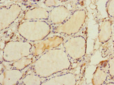 RHOBTB1 Antibody - Immunohistochemistry of paraffin-embedded human thyroid tissue at dilution 1:100