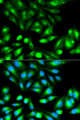 RHOC Antibody - Immunofluorescence analysis of HeLa cells using RHOC antibody. Blue: DAPI for nuclear staining.