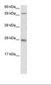 Rhox11 Antibody - SP2/0 Cell Lysate.  This image was taken for the unconjugated form of this product. Other forms have not been tested.