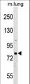 RHPN1 / RHOPHILIN Antibody - RHPN1 Antibody western blot of mouse lung tissue lysates (35 ug/lane). The RHPN1 antibody detected the RHPN1 protein (arrow).