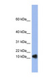 Ribonuclease A / RNASE1 Antibody - RNASE1 / Ribonuclease A antibody Western blot of Fetal Spleen lysate. This image was taken for the unconjugated form of this product. Other forms have not been tested.