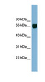 RIC8B Antibody - RIC8B antibody Western blot of Jurkat lysate. This image was taken for the unconjugated form of this product. Other forms have not been tested.