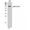 RICK / RIP2 Antibody - Western blot of Phospho-RIP2 (S176) antibody