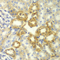 RICK / RIP2 Antibody - Immunohistochemistry of paraffin-embedded rat kidney tissue.