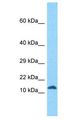 RIIAD1 Antibody - RIIAD1 antibody Western Blot of Jurkat. Antibody dilution: 1 ug/ml.  This image was taken for the unconjugated form of this product. Other forms have not been tested.