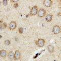 RIMS4 Antibody - Immunohistochemical analysis of RIMS4 staining in human brain formalin fixed paraffin embedded tissue section. The section was pre-treated using heat mediated antigen retrieval with sodium citrate buffer (pH 6.0). The section was then incubated with the antibody at room temperature and detected with HRP and DAB as chromogen. The section was then counterstained with hematoxylin and mounted with DPX.