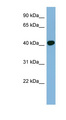 RING1 Antibody - RING1 antibody Western blot of COLO205 cell lysate. This image was taken for the unconjugated form of this product. Other forms have not been tested.