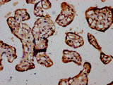 RIOK2 Antibody - Immunohistochemistry Dilution at 1:400 and staining in paraffin-embedded human placenta tissue performed on a Leica BondTM system. After dewaxing and hydration, antigen retrieval was mediated by high pressure in a citrate buffer (pH 6.0). Section was blocked with 10% normal Goat serum 30min at RT. Then primary antibody (1% BSA) was incubated at 4°C overnight. The primary is detected by a biotinylated Secondary antibody and visualized using an HRP conjugated SP system.