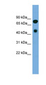 RIP4 / ANKRD3 Antibody - RIPK4 antibody Western blot of Fetal Heart lysate. This image was taken for the unconjugated form of this product. Other forms have not been tested.