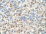 RIPK3 / RIP3 Antibody - RIPK3 / RIP3 antibody ARP31513_T100-NP_006862-RIPK3(receptor-interacting serine-threonine kinase 3) Antibody was used in IHC to stain formalin-fixed, paraffin-embedded human liver.  This image was taken for the unconjugated form of this product. Other forms have not been tested.