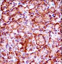 RIPK3 / RIP3 Antibody - RIPK3 Antibody immunohistochemistry of formalin-fixed and paraffin-embedded human pancreas tissue followed by peroxidase-conjugated secondary antibody and DAB staining.