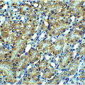 RIPK3 / RIP3 Antibody - Immunohistochemistry of RIP3 in mouse kidney tissue with RIP3 Antibody at 2.5 µg/mL.