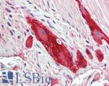RLBP1 / CRALBP Antibody - Human Small Intestine, Myenteric Plexus: Formalin-Fixed, Paraffin-Embedded (FFPE)