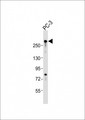 RLF Antibody - Anti-RLF Antibody (C-Term)at 1:2000 dilution + PC-3 whole cell lysates Lysates/proteins at 20 ug per lane. Secondary Goat Anti-Rabbit IgG, (H+L), Peroxidase conjugated at 1:10000 dilution. Predicted band size: 218 kDa. Blocking/Dilution buffer: 5% NFDM/TBST.