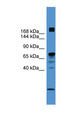 RLF Antibody - RLF antibody Western blot of PANC1 cell lysate. This image was taken for the unconjugated form of this product. Other forms have not been tested.