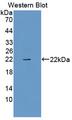 RLN1 / Relaxin Antibody - Western blot of RLN1 / Relaxin antibody.