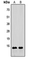 RLN3 / Relaxin 3 Antibody - Western blot analysis of Relaxin 3 expression in HeLa (A); Raw264.7 (B) whole cell lysates.