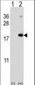 RMA1 / RNF5 Antibody - Western blot of RNF5 (arrow) using rabbit polyclonal RNF5 Antibody. 293 cell lysates (2 ug/lane) either nontransfected (Lane 1) or transiently transfected (Lane 2) with the RNF5 gene.