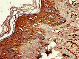 RNASEH2C / AGS3 Antibody - Immunohistochemistry image of paraffin-embedded human skin tissue at a dilution of 1:100