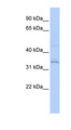RNF113A Antibody - RNF113A antibody Western blot of Transfected 293T cell lysate. This image was taken for the unconjugated form of this product. Other forms have not been tested.