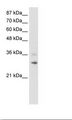 RNF113B Antibody - HepG2 Cell Lysate.  This image was taken for the unconjugated form of this product. Other forms have not been tested.