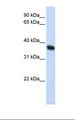 RNF115 / BCA2 Antibody - HepG2 cell lysate. Antibody concentration: 1.0 ug/ml. Gel concentration: 12%.  This image was taken for the unconjugated form of this product. Other forms have not been tested.