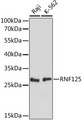 RNF125 / TRAC-1 Antibody - Western blot analysis of extracts of various cell lines, using RNF125 antibody at 1:1000 dilution. The secondary antibody used was an HRP Goat Anti-Rabbit IgG (H+L) at 1:10000 dilution. Lysates were loaded 25ug per lane and 3% nonfat dry milk in TBST was used for blocking. An ECL Kit was used for detection and the exposure time was 30s.