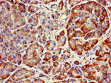 RNF126 Antibody - Immunohistochemistry of paraffin-embedded human pancreatic tissue using RNF126 Antibody at dilution of 1:100