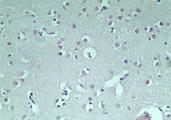 RNF128 / GRAIL Antibody - IHC of normal human brain using control (rabbit Ig) at 5 ug/ml.