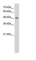 RNF128 / GRAIL Antibody - HepG2 Cell Lysate.  This image was taken for the unconjugated form of this product. Other forms have not been tested.