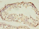 RNF133 Antibody - Immunohistochemistry of paraffin-embedded human testis using antibody at 1:100 dilution.  This image was taken for the unconjugated form of this product. Other forms have not been tested.