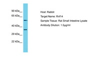 RNF14 / ARA54 Antibody -  This image was taken for the unconjugated form of this product. Other forms have not been tested.