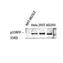 RNF144B Antibody - Western blot of RNF144b antibody