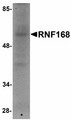 RNF168 Antibody - Western blot of RNF168 in human brain tissue lysate with RNF168 antibody at 1 ug/ml.